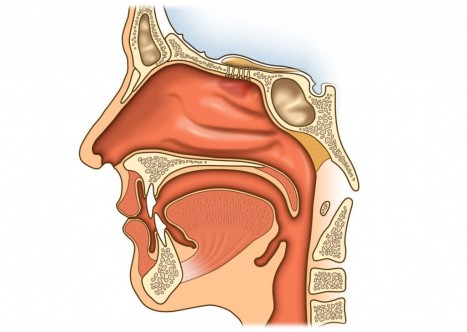 Лечение заложенности уха — частые причины и их симптомы